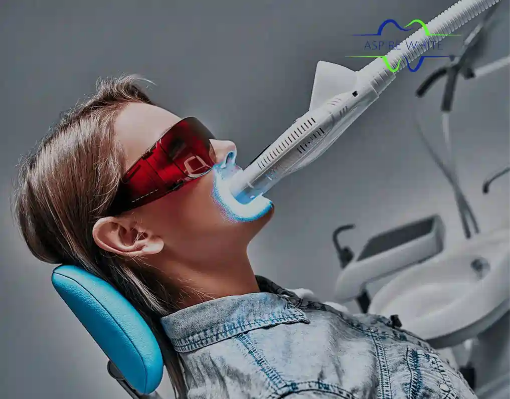 1 Hour Teeth Whitening with Aspire White Bedford