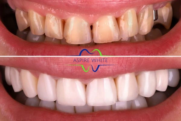 Before And After Results Bedford