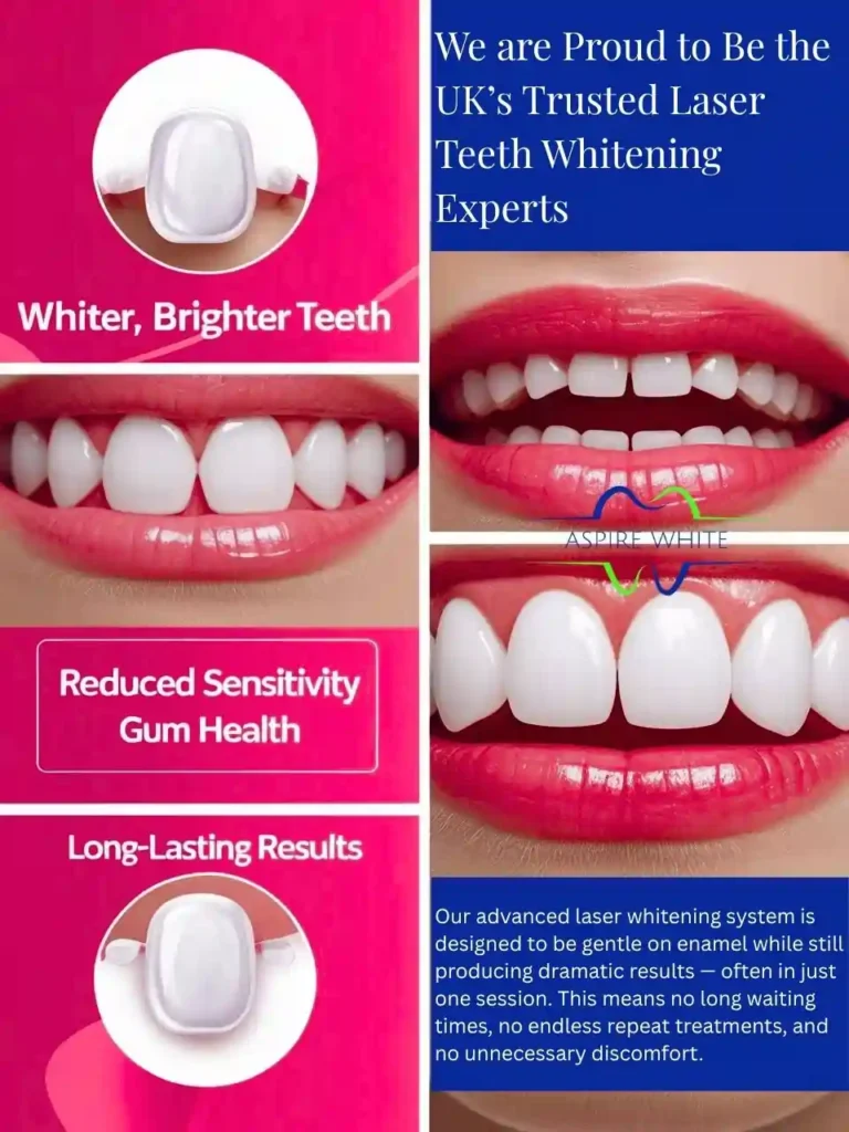 We are Proud to Be the UK’s Trusted Laser Teeth Whitening Experts Bedford